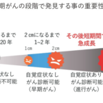がん細胞新
