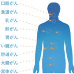 検出可能がん